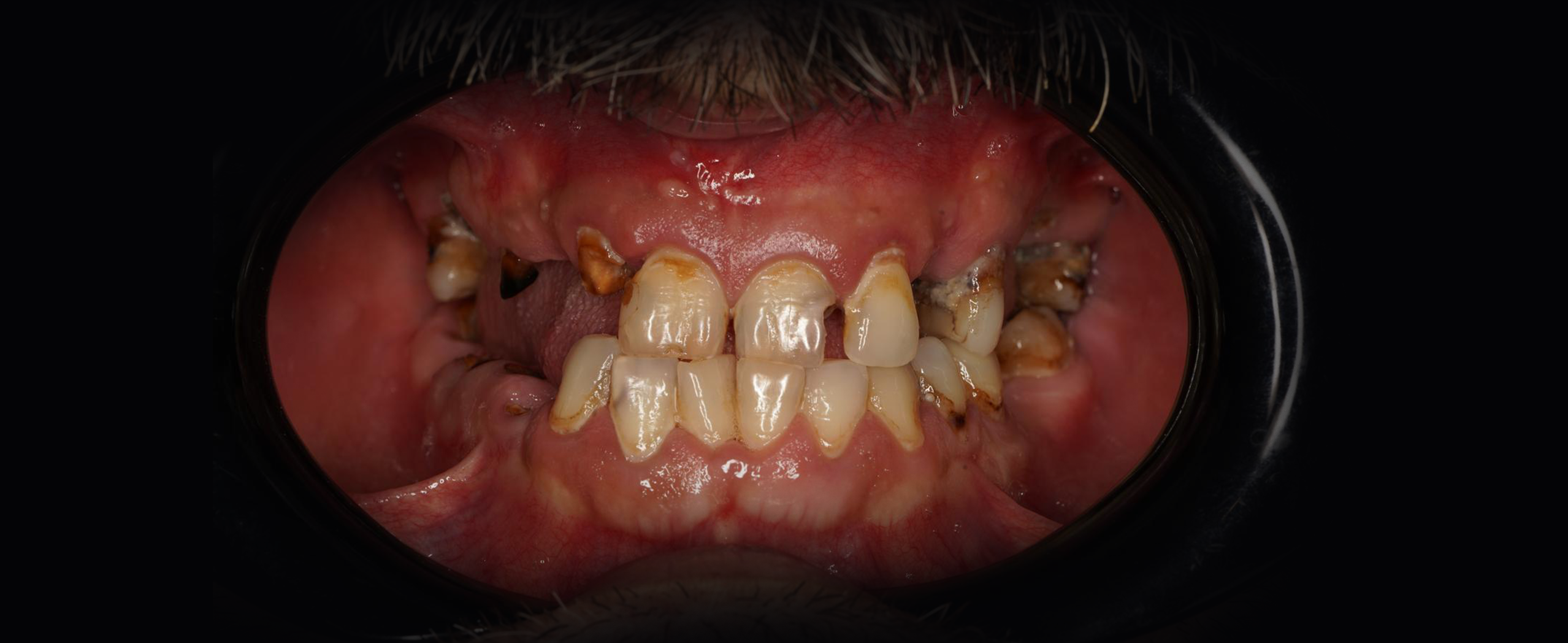 Urgente dentare in Sector 3